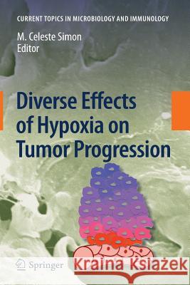 Diverse Effects of Hypoxia on Tumor Progression M. Celeste Simon 9783642264849 Springer - książka