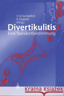 Divertikulitis: Eine Standortbestimmung Schumpelick, V. 9783540420446 Springer - książka