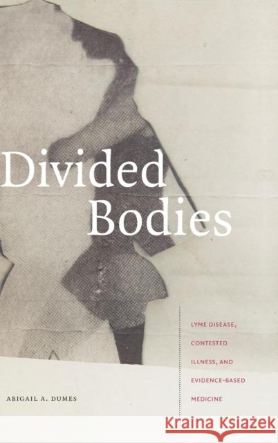 Divided Bodies: Lyme Disease, Contested Illness, and Evidence-Based Medicine Abigail A. Dumes 9781478005988 Duke University Press - książka