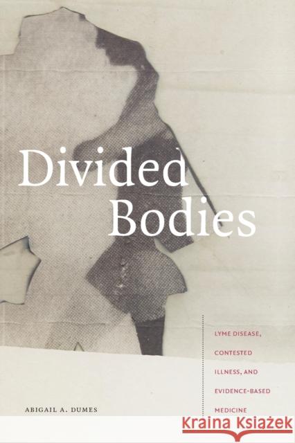 Divided Bodies: Lyme Disease, Contested Illness, and Evidence-Based Medicine Abigail A. Dumes 9781478006664 Duke University Press - książka