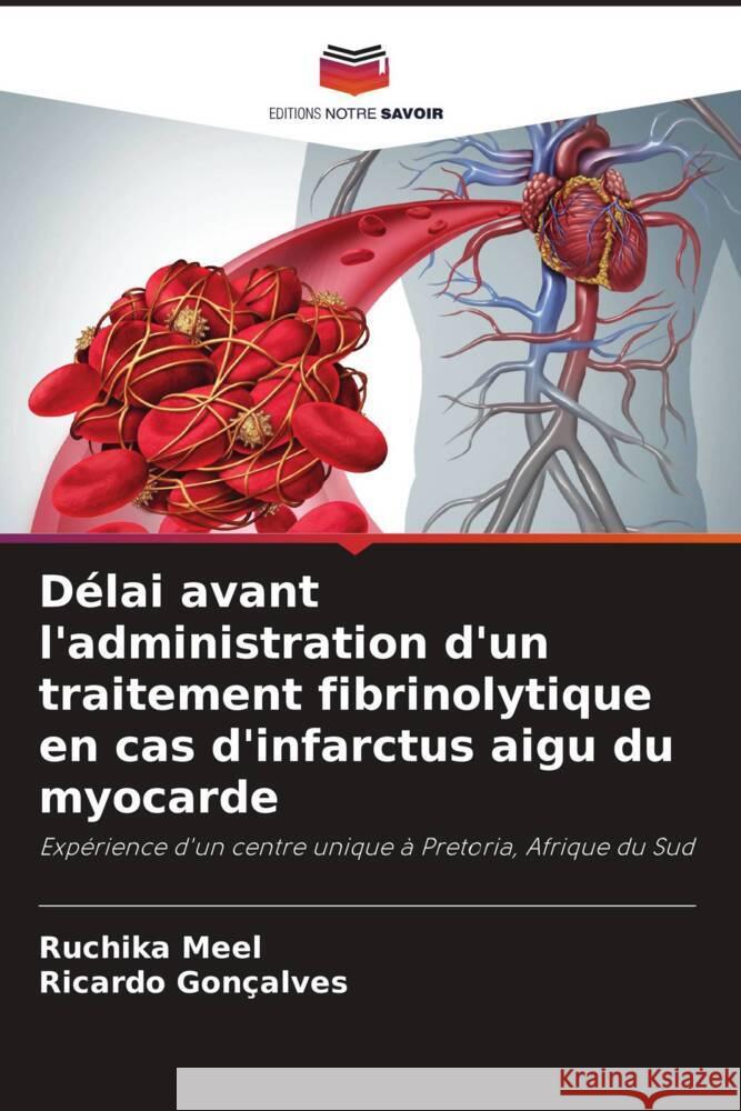 Délai avant l'administration d'un traitement fibrinolytique en cas d'infarctus aigu du myocarde Meel, Ruchika, Gonçalves, Ricardo 9786203472790 Editions Notre Savoir - książka