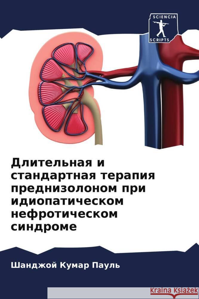 Dlitel'naq i standartnaq terapiq prednizolonom pri idiopaticheskom nefroticheskom sindrome Paul', Shandzhoj Kumar 9786207982028 Sciencia Scripts - książka