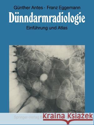 Dünndarmradiologie: Einführung Und Atlas Antes, Günther 9783662067819 Springer - książka