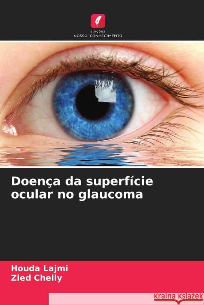 Doença da superfície ocular no glaucoma Lajmi, Houda, Chelly, Zied 9786204994659 Edições Nosso Conhecimento - książka