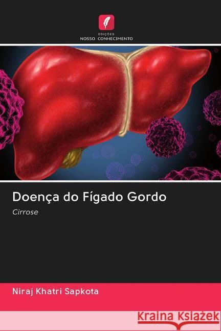 Doença do Fígado Gordo Khatri Sapkota, Niraj 9786202597258 Edicoes Nosso Conhecimento - książka