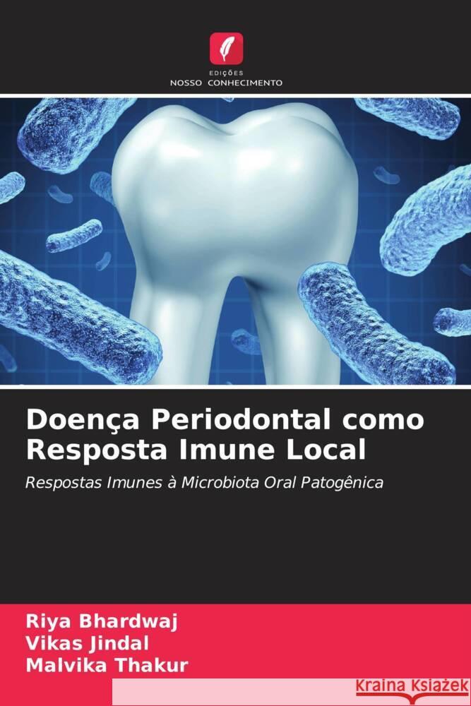 Doença Periodontal como Resposta Imune Local Bhardwaj, RIYA, Jindal, Vikas, Thakur, Malvika 9786205446010 Edições Nosso Conhecimento - książka