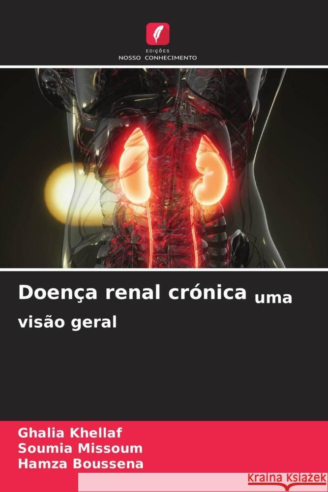 Doen?a renal cr?nica uma vis?o geral Ghalia Khellaf Soumia Missoum Hamza Boussena 9786207390557 Edicoes Nosso Conhecimento - książka