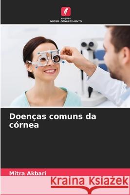 Doenças comuns da córnea Akbari, Mitra 9786209056864 Edições Nosso Conhecimento - książka