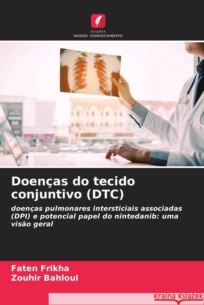 Doen?as do tecido conjuntivo (DTC) Faten Frikha Zouhir Bahloul 9786207421985 Edicoes Nosso Conhecimento - książka