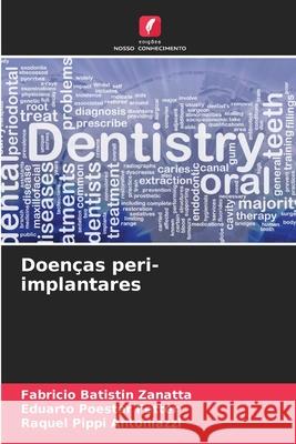 Doenças peri-implantares Batistin Zanatta, Fabricio, Poester Fetter, Eduarto, Pippi Antoniazzi, Raquel 9786208693886 Edições Nosso Conhecimento - książka