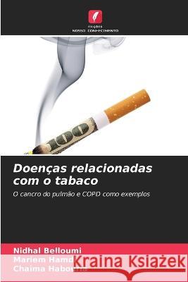 Doenças relacionadas com o tabaco Nidhal Belloumi, Mariem Hamdi, Chaima Habouria 9786205264225 Edicoes Nosso Conhecimento - książka