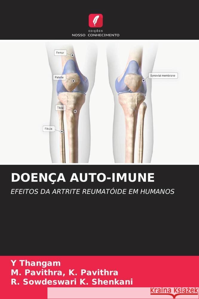 Doenca Auto-Imune Y Thangam M Pavithra K Pavithra R Sowdeswari K Shenkani 9786205896358 Edicoes Nosso Conhecimento - książka