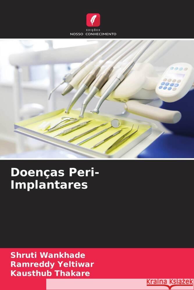 Doencas Peri-Implantares Shruti Wankhade Ramreddy Yeltiwar Kausthub Thakare 9786205759806 Edicoes Nosso Conhecimento - książka