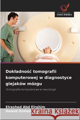 Dokladnośc tomografii komputerowej w diagnostyce glejak?w m?zgu Elrashed Ab Hamid Osman 9786202042031 Wydawnictwo Nasza Wiedza - książka