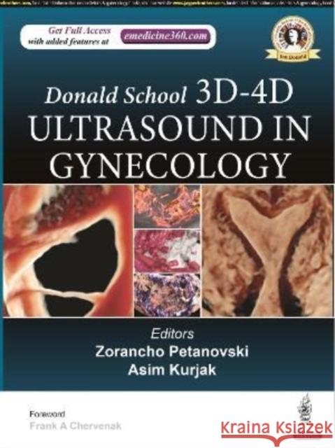 Donald School 3D-4D Ultrasound in Gynecology Zorancho Petanovski Asim Kurjak  9789354650048 Jaypee Brothers Medical Publishers - książka