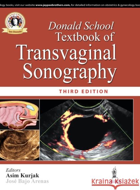 Donald School Textbook of Transvaginal Sonography Asim Kurjak 9789352701971 Jp Medical Ltd - książka