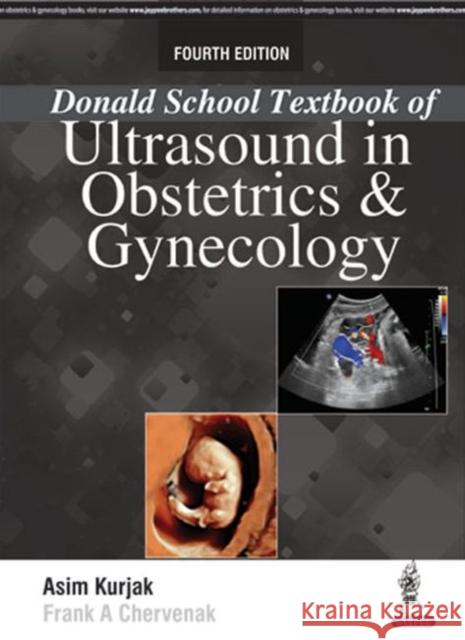 Donald School Textbook of Ultrasound in Obstetrics & Gynaecology Asim Kurjak 9789386056870 Jaypee Brothers, Medical Publishers Pvt. Ltd. - książka