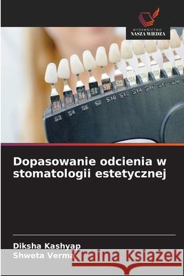Dopasowanie odcienia w stomatologii estetycznej Kashyap, Diksha, Verma, Shweta 9786202454360 Wydawnictwo Nasza Wiedza - książka