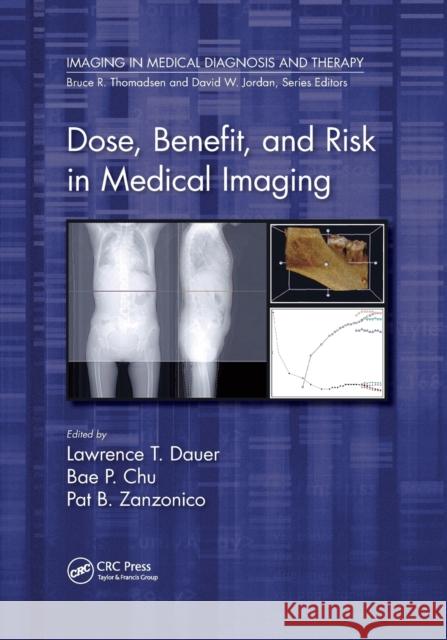 Dose, Benefit, and Risk in Medical Imaging Lawrence T. Dauer Bae P. Chu Pat B. Zanzonico 9780367656966 CRC Press - książka