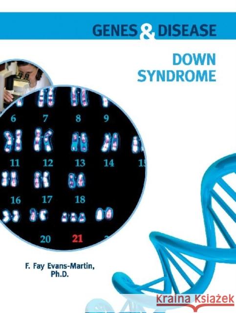 Down Syndrome Ph. D. F 9780791096444 Chelsea House Publishers - książka