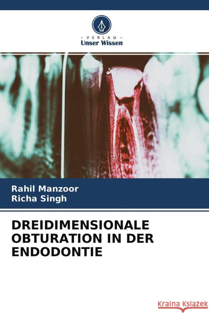 DREIDIMENSIONALE OBTURATION IN DER ENDODONTIE Manzoor, Rahil, Singh, Richa 9786204556031 Verlag Unser Wissen - książka