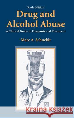 Drug and Alcohol Abuse: A Clinical Guide to Diagnosis and Treatment Schuckit, Marc a. 9780387257327 Springer - książka