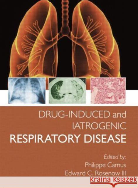 Drug-Induced and Iatrogenic Respiratory Disease Camus, Phillipe 9780340809730  - książka
