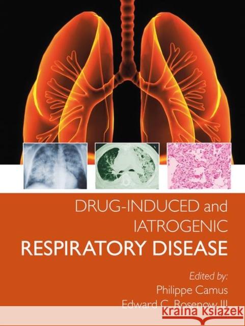 Drug-Induced and Iatrogenic Respiratory Disease Phillipe Camus Edward Roseno 9780367452308 CRC Press - książka