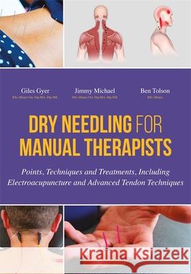 Dry Needling for Manual Therapists: Points, Techniques and Treatments, Including Electroacupuncture and Advanced Tendon Techniques Giles Gyer 9781848192553 Jessica Kingsley Publishers - książka