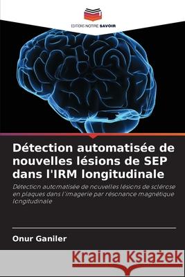 Détection automatisée de nouvelles lésions de SEP dans l'IRM longitudinale Ganiler, Onur 9786208982683 Editions Notre Savoir - książka