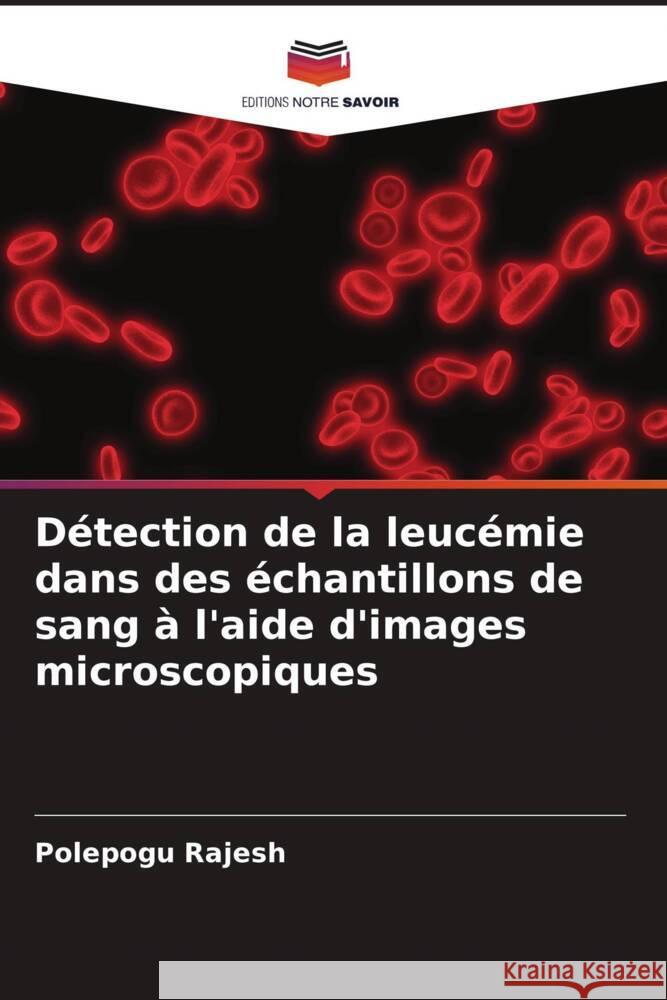 Détection de la leucémie dans des échantillons de sang à l'aide d'images microscopiques Rajesh, Polepogu 9786204696959 Editions Notre Savoir - książka