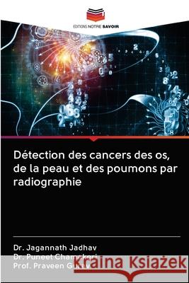 Détection des cancers des os, de la peau et des poumons par radiographie Jadhav, Jagannath 9786202834148 Editions Notre Savoir - książka