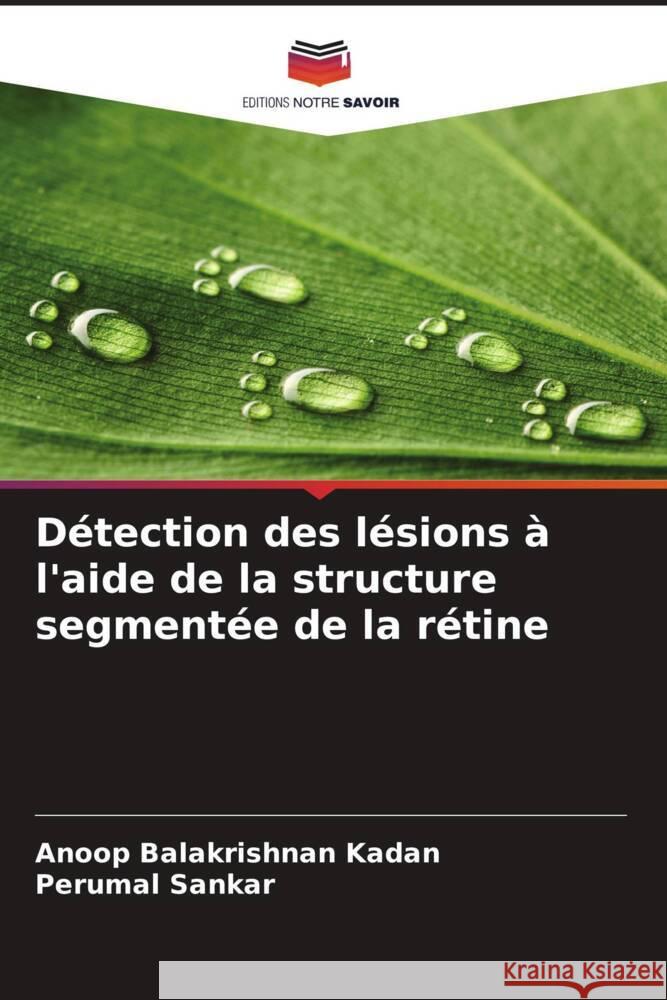 Détection des lésions à l'aide de la structure segmentée de la rétine Balakrishnan Kadan, Anoop, Sankar, Perumal 9786208239381 Editions Notre Savoir - książka