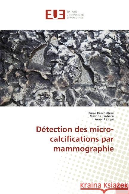 Détection des micro-calcifications par mammographie Ben Sellem, Dorra; Trabelsi, Nesrine; Rezgui, Amal 9786202273237 Éditions universitaires européennes - książka