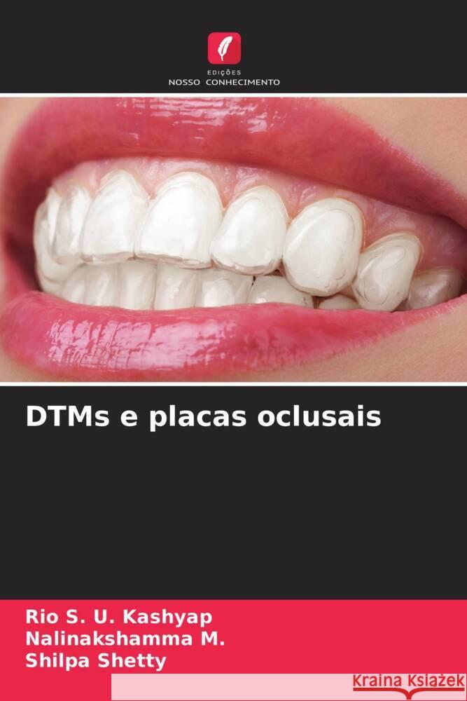 DTMs e placas oclusais Rio S. U. Kashyap Nalinakshamma M Shilpa Shetty 9786208025748 Edicoes Nosso Conhecimento - książka