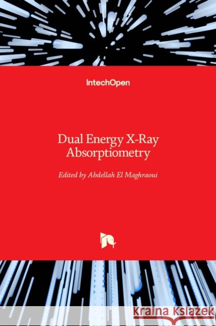 Dual Energy X-Ray Absorptiometry Abdellah E 9789533078779 Intechopen - książka