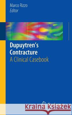 Dupuytren's Contracture: A Clinical Casebook Rizzo, Marco 9783319238401 Springer - książka