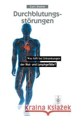 Durchblutungsstörungen: Was Hilft Bei Erkrankungen Der Blutund Lymphgefäße? Diehm, Curt 9783540605270 Springer - książka
