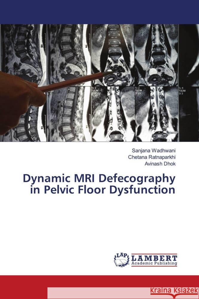 Dynamic MRI Defecography in Pelvic Floor Dysfunction Wadhwani, Sanjana, Ratnaparkhi, Chetana, Dhok, Avinash 9786204752204 LAP Lambert Academic Publishing - książka