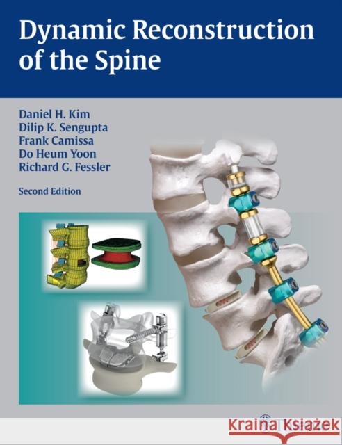 Dynamic Reconstruction of the Spine Daniel H. Kim Frank P. Cammis Richard Glenn Fessler 9781604068733 Thieme Medical Publishers - książka