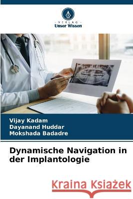 Dynamische Navigation in der Implantologie Vijay Kadam Dayanand Huddar Mokshada Badadre 9786206000471 Verlag Unser Wissen - książka