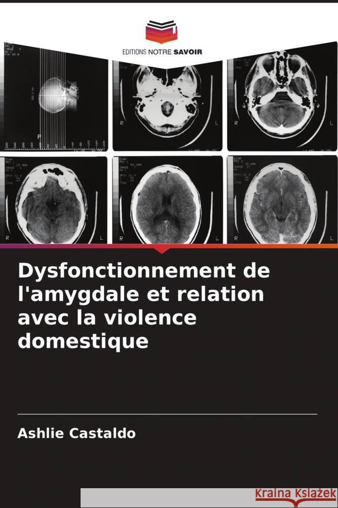 Dysfonctionnement de l'amygdale et relation avec la violence domestique Ashlie Castaldo 9786207313808 Editions Notre Savoir - książka