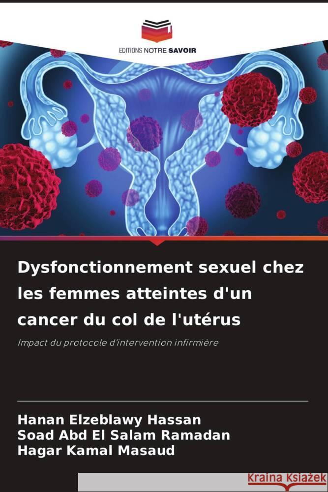 Dysfonctionnement sexuel chez les femmes atteintes d'un cancer du col de l'ut?rus Hanan Elzeblawy Hassan Soad Abd El Salam Ramadan Hagar Kamal Masaud 9786207196630 Editions Notre Savoir - książka