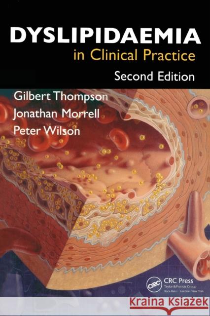 Dyslipidaemia in Clinical Practice Gilbert Thompson Jonathan Morrell Peter Wilson 9781841845937 Informa Healthcare - książka
