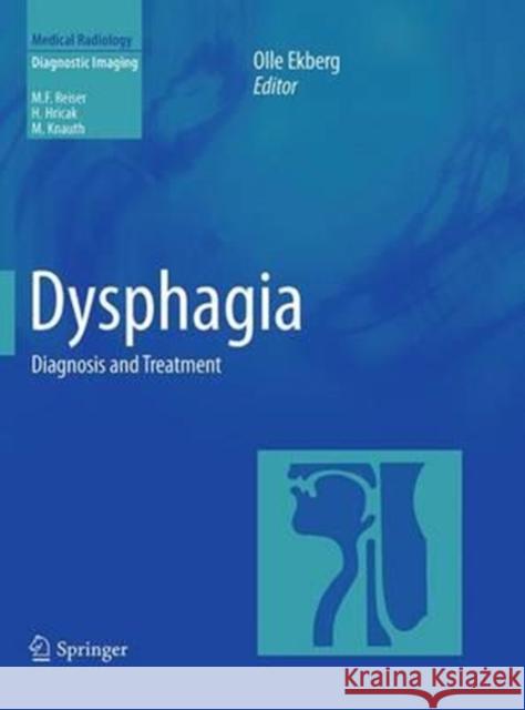 Dysphagia: Diagnosis and Treatment Ekberg, Olle 9783662506974 Springer - książka