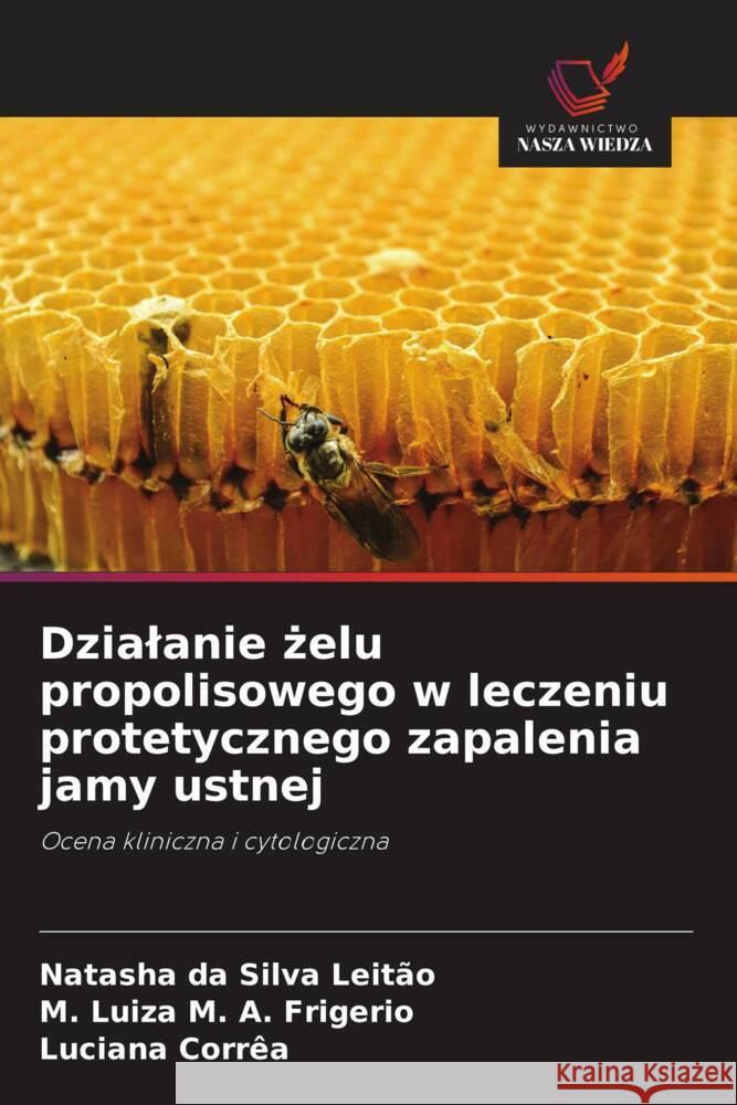 Dzialanie zelu propolisowego w leczeniu protetycznego zapalenia jamy ustnej Leitão, Natasha da Silva, A. Frigerio, M. Luiza M., Corrêa, Luciana 9786208551841 Wydawnictwo Nasza Wiedza - książka