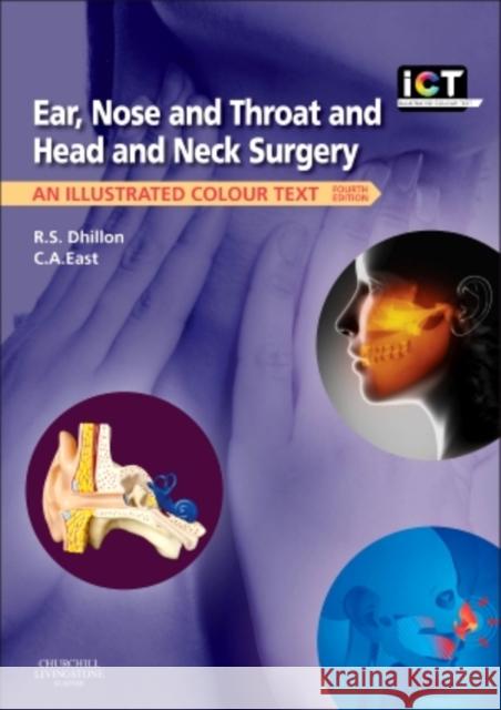 Ear, Nose and Throat and Head and Neck Surgery: An Illustrated Colour Text Dhillon, R. S. 9780702044199 CHURCHILL LIVINGSTONE - książka