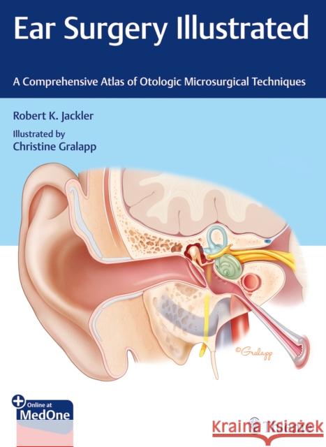 Ear Surgery Illustrated: A Comprehensive Atlas of Otologic Microsurgical Techniques Robert K. Jackler 9781684201105 Thieme Medical Publishers Inc - książka