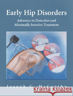 Early Hip Disorders: Advances in Detection and Minimally Invasive Treatment McCarthy, Joseph C. 9780387986029 Springer - książka