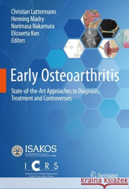 Early Osteoarthritis: State-Of-The-Art Approaches to Diagnosis, Treatment and Controversies Christian Lattermann Henning Madry Norimasa Nakamura 9783030794842 Springer - książka